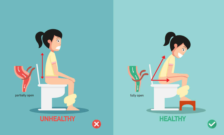 ungesunde versus gesunde Position für Stuhlgang mit Toilettenhocker